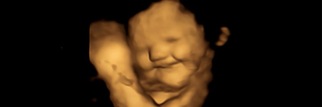 4-D ultrasound scan of a baby showing a laugh face reaction