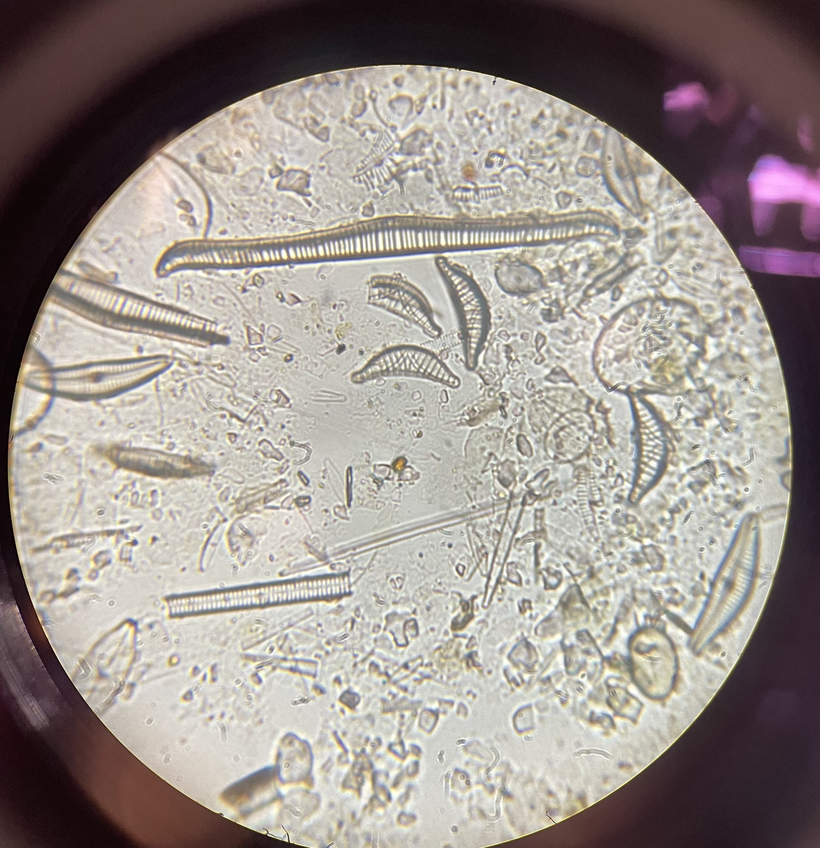 diatoms, algae