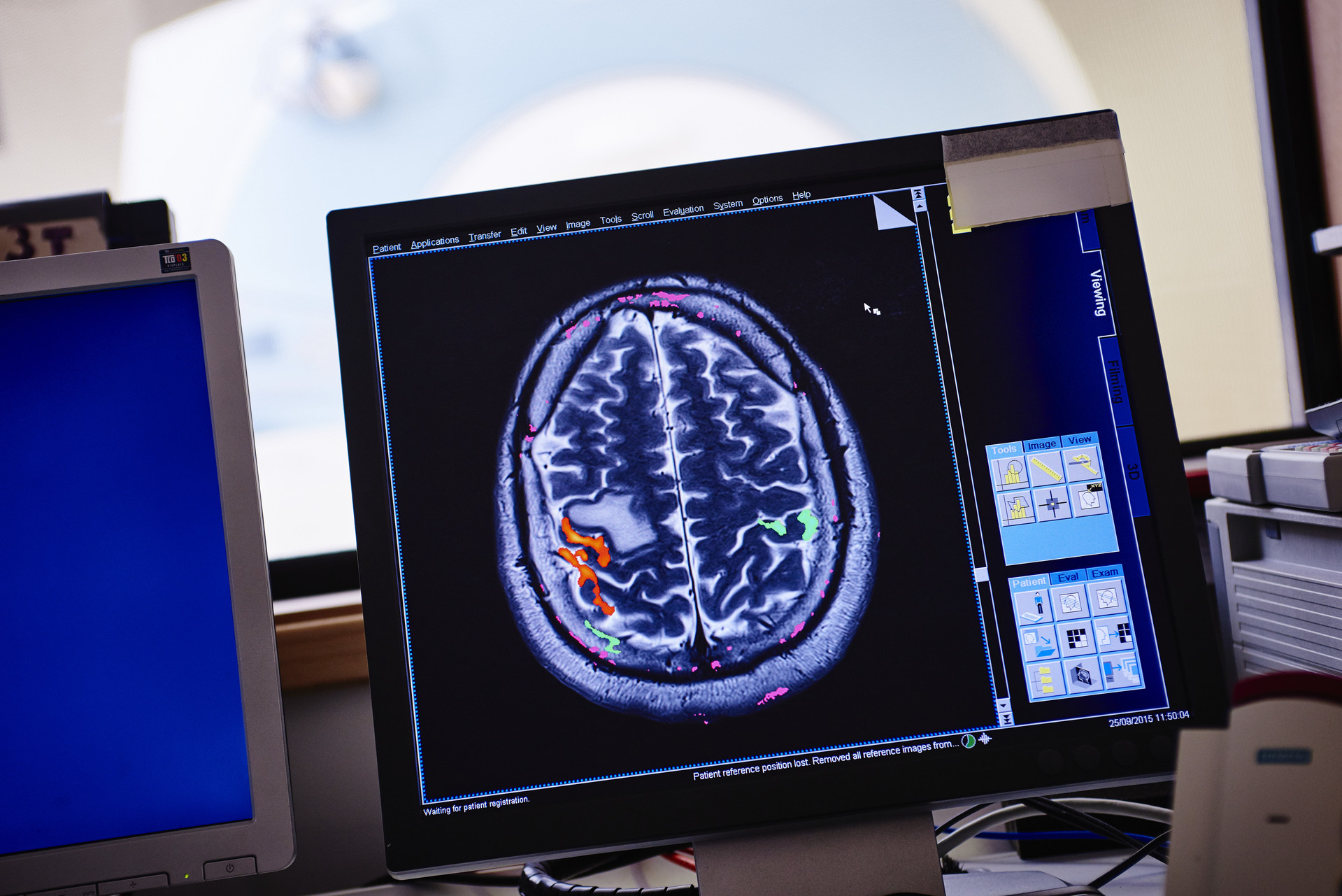 A computer monitor displaying brain data in fMRI control room.